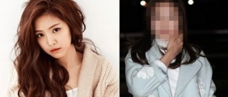 網民指最近的照片顯示A Pink Son Naeun注射了了botox