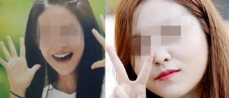Red Velvet Yeri過去的照片引發做了雙眼皮手術的猜測