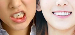 12位偶像的牙齒相片可能會讓你感到抖不過氣