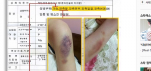BREAKING: 金賢重前女友的受傷害圖片公開